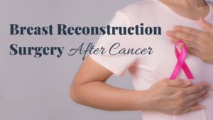 breast implant reconstruction surgery patient