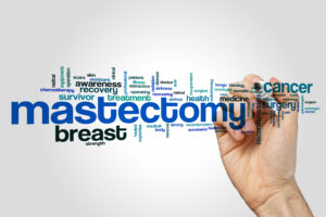 Mastectomy-breast-surgery