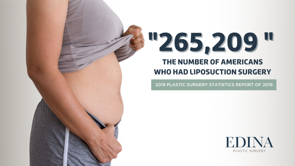 Liposuction Statistics