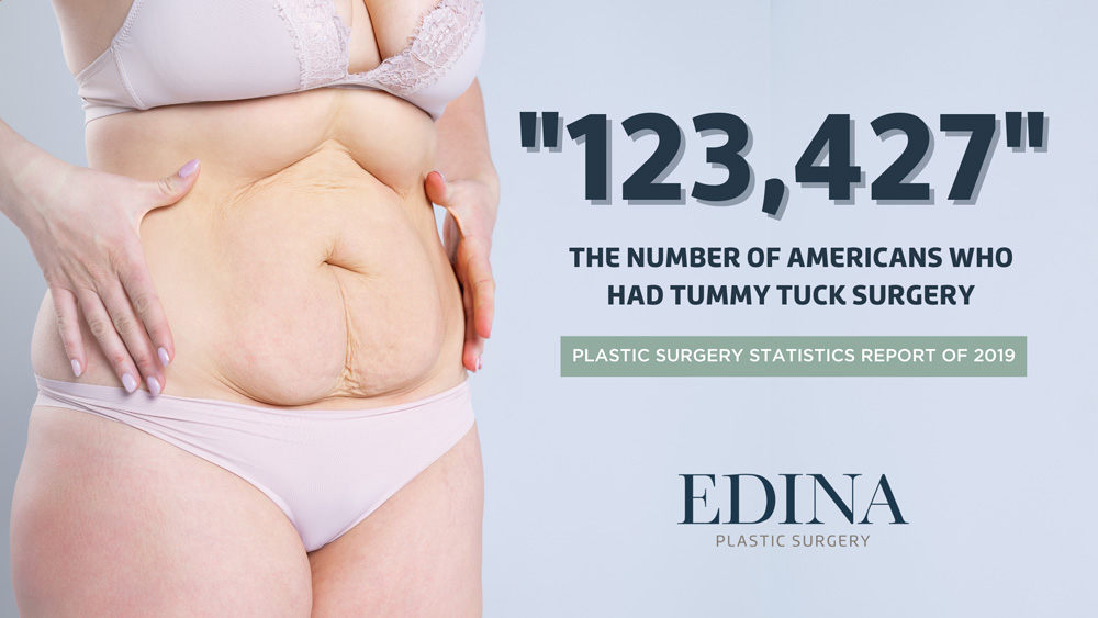 10 Tips for the Best Tummy Tuck Results