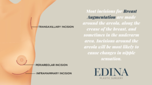 incisions nipple sensitivity