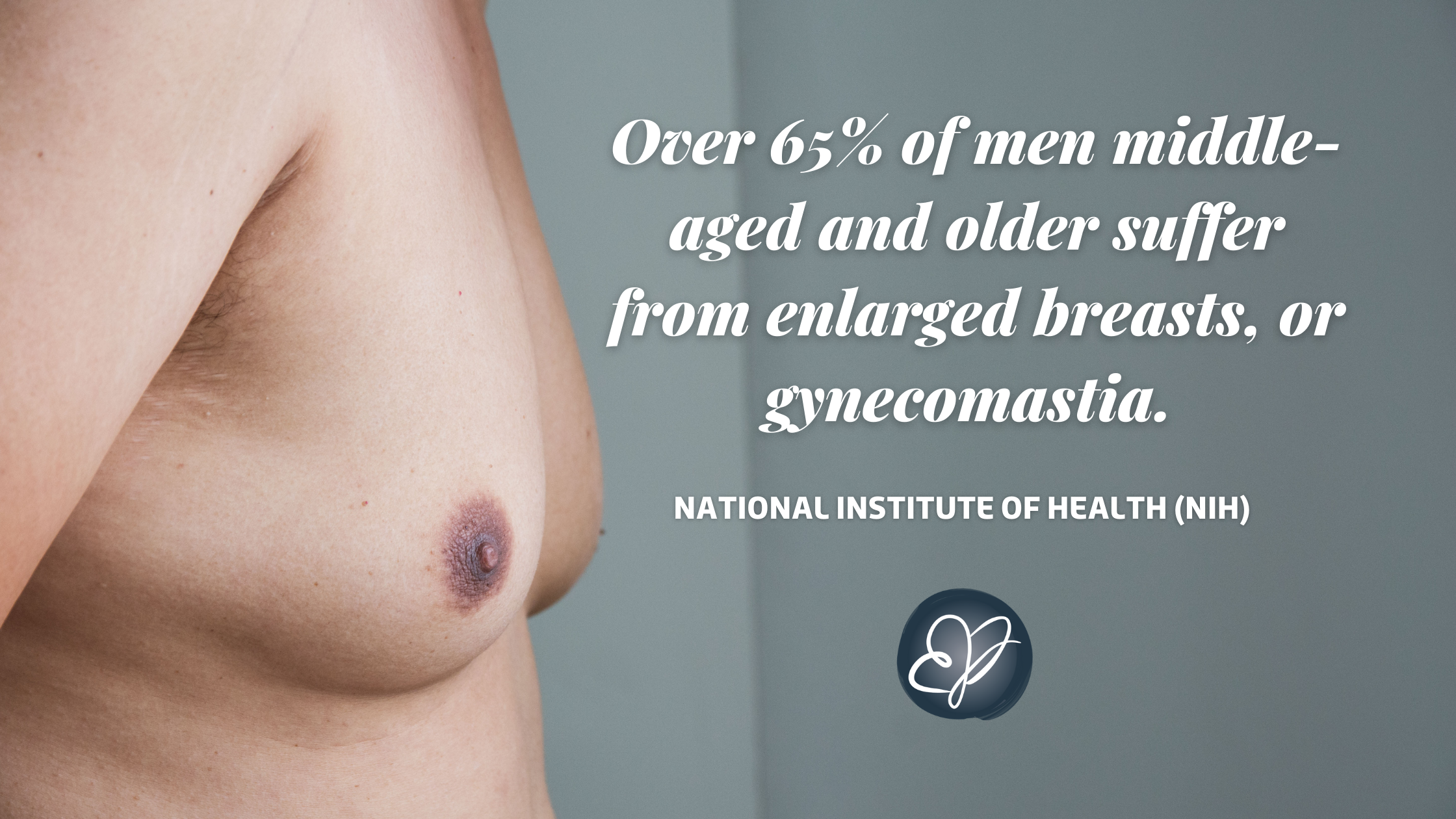 male breast reduction quote