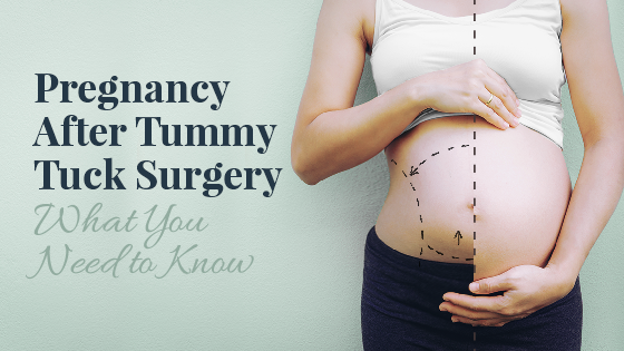 Tummy Tuck After Pregnancy