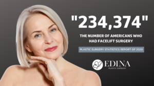 Facelift Statistics