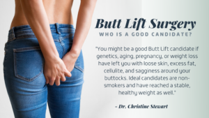 butt lift candidate