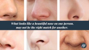 nose shapes for rhinoplasty