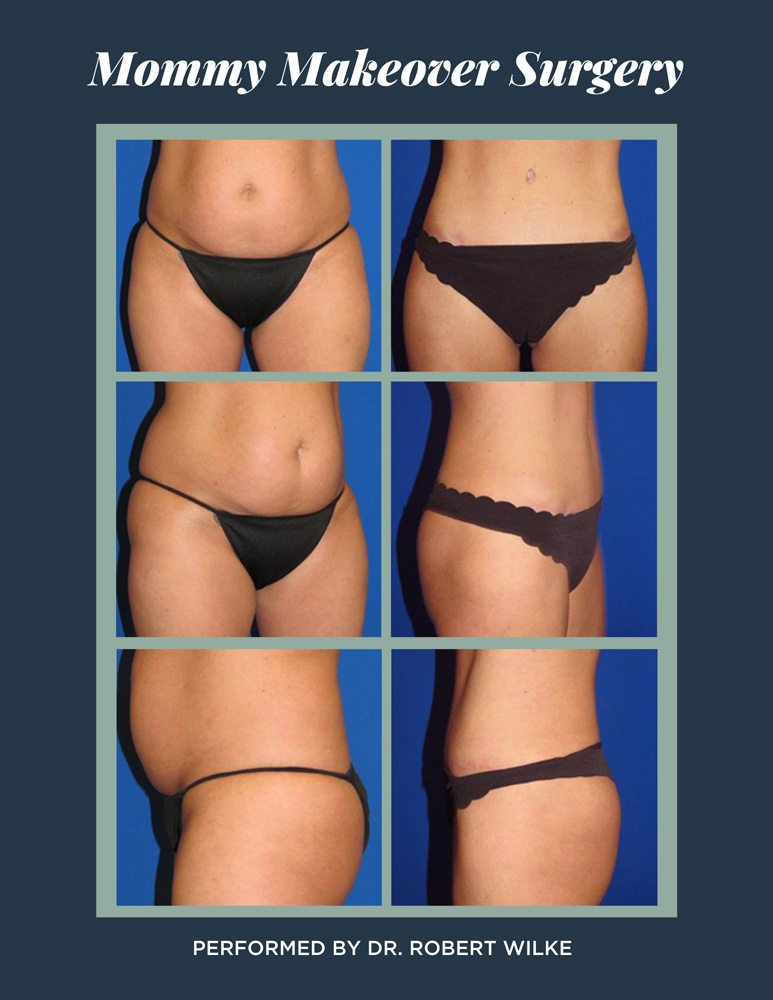 A Trussler Md Body Surgery