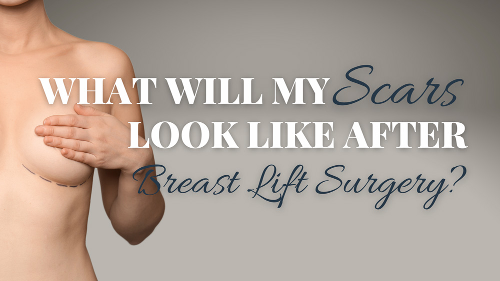 https://www.edinaplasticsurgery.com/wp-content/uploads/2022/04/Breast-Lift-Scars-Blog-Header.jpg