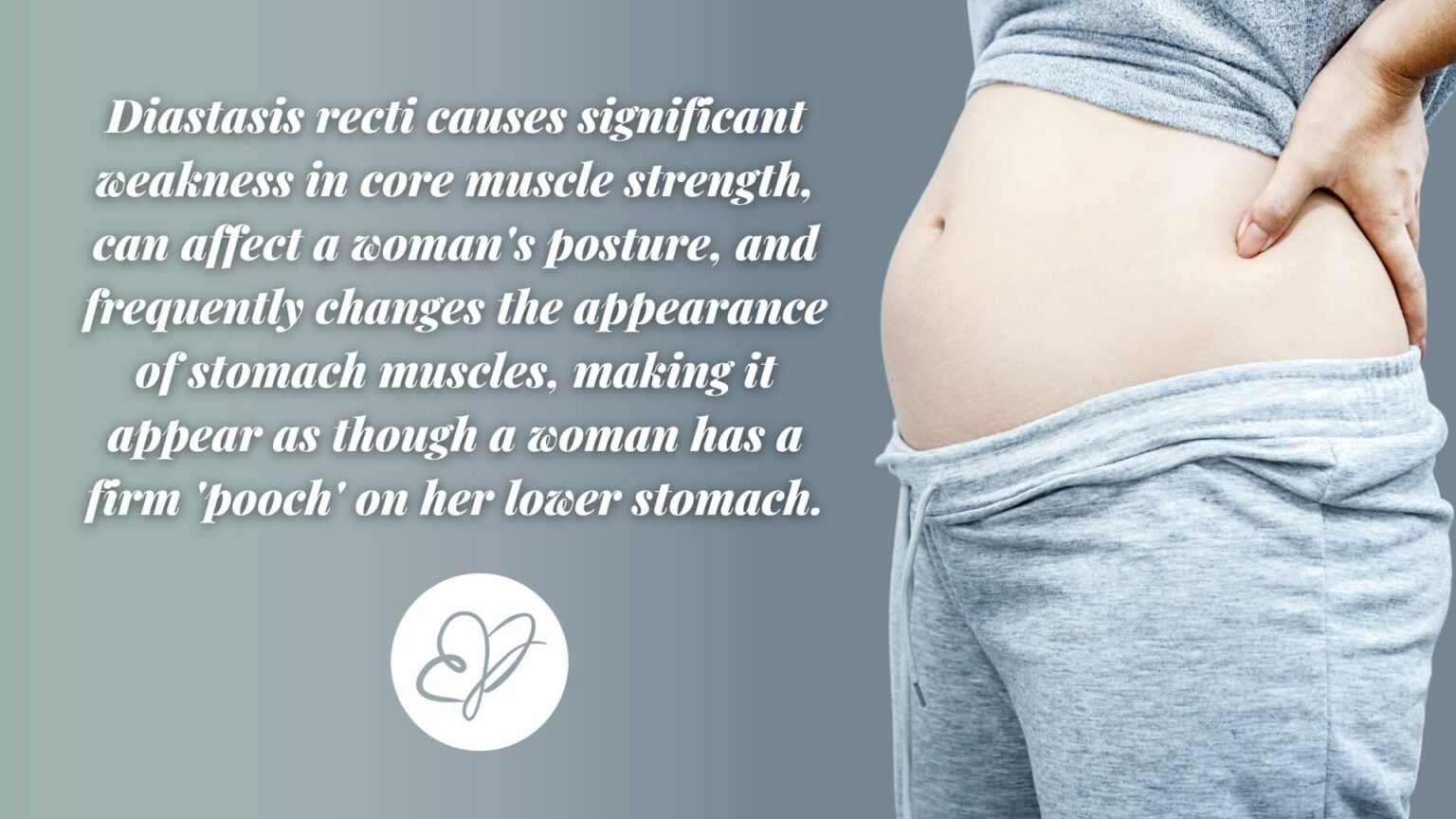 Split Belly Button Abdominal Separation Surgery After Pregnancy: What You Need to Know ...